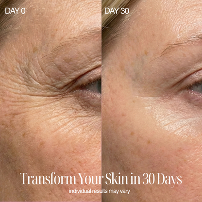 4-in-1 Regenelle Anti-Aging Wand