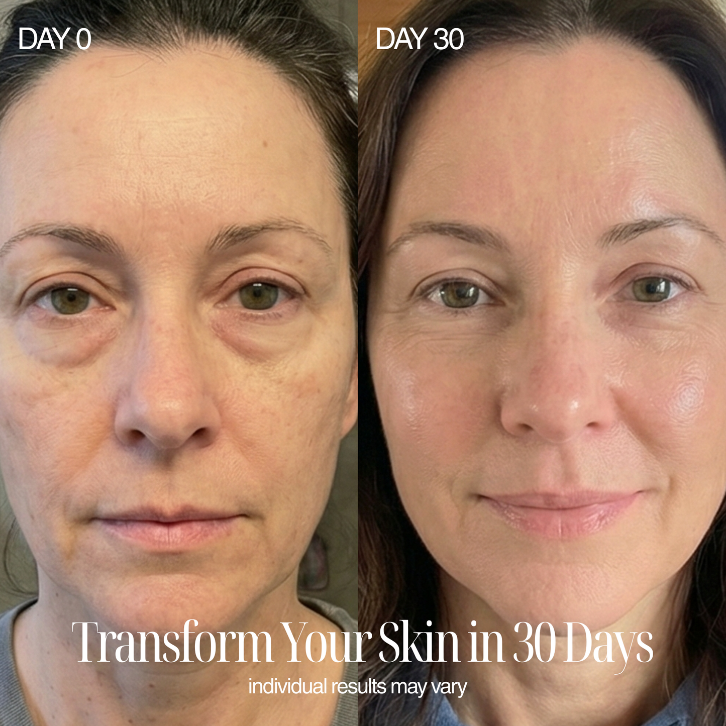 4-in-1 Regenelle Anti-Aging Wand