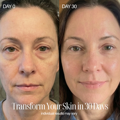 4-in-1 Regenelle Anti-Aging Wand