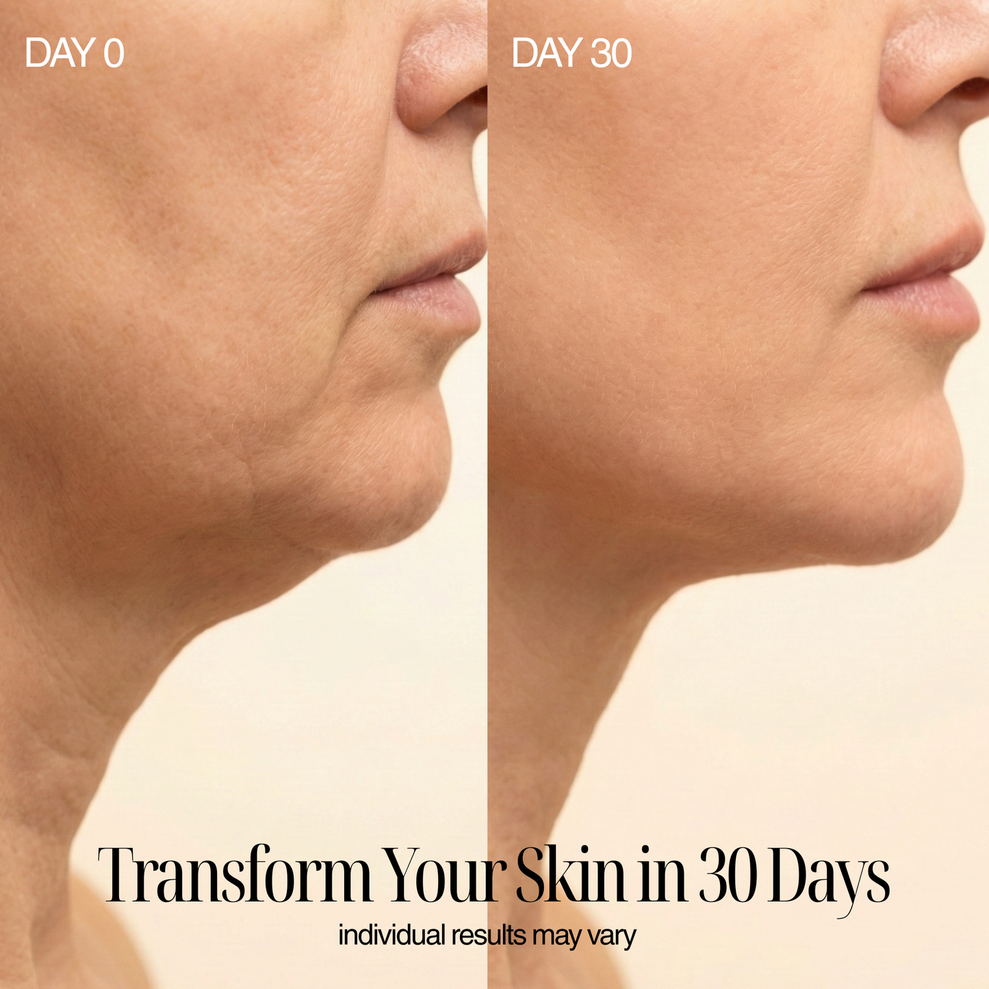 4-in-1 Regenelle Anti-Aging Wand