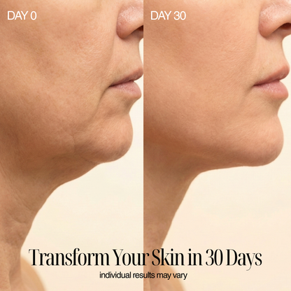 4-in-1 Regenelle Anti-Aging Wand