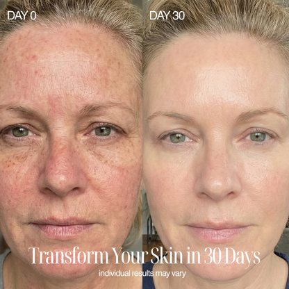 4-in-1 Regenelle Anti-Aging Wand