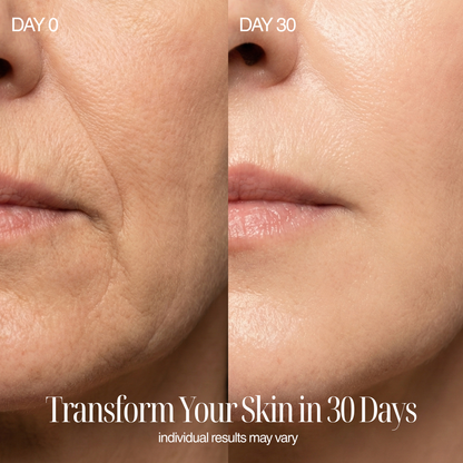 4-in-1 Regenelle Anti-Aging Wand